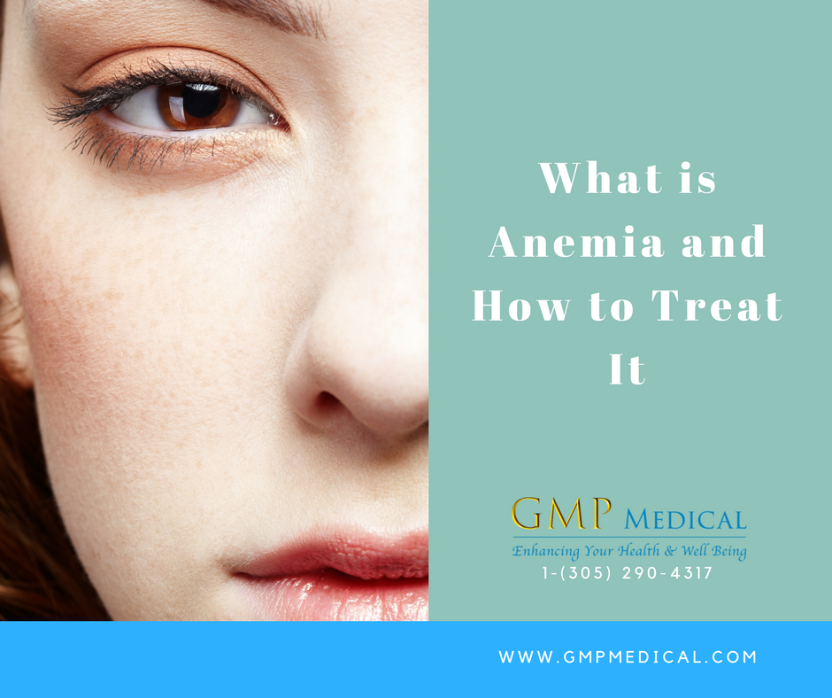 What is Anemia and How to Treat It