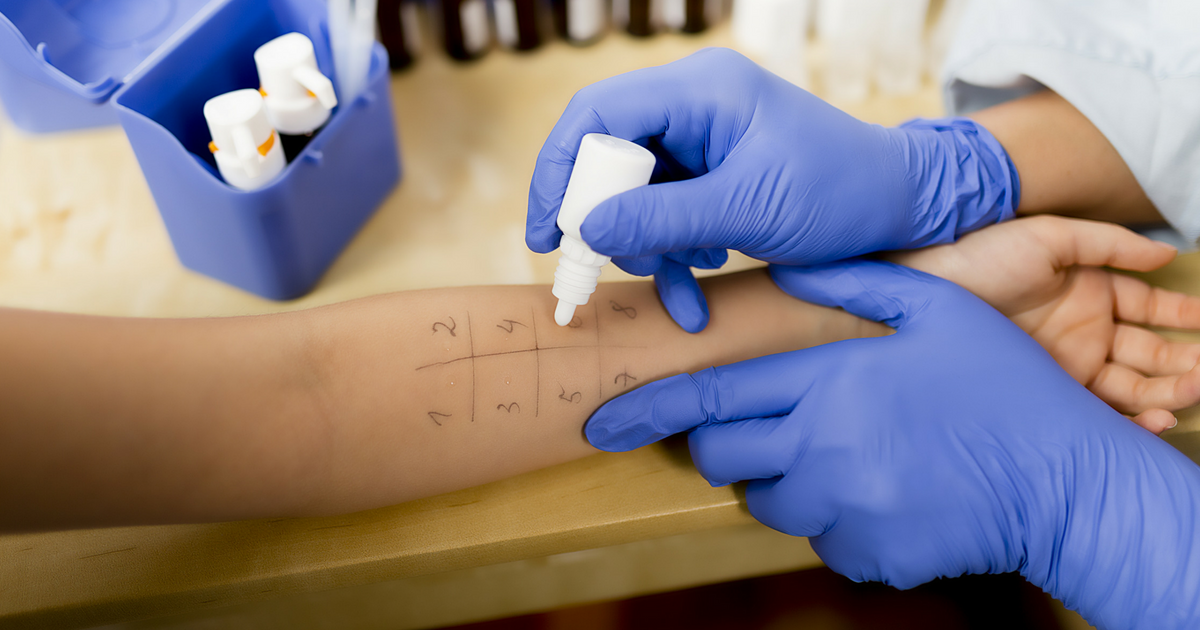 Allergy Testing Procedure