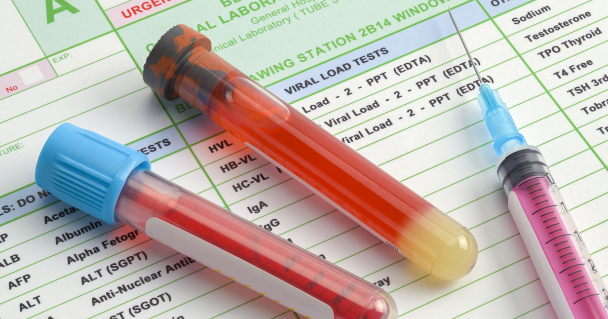 Blood Test Results Meaning