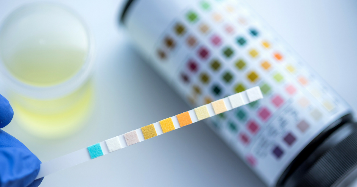 Dipstick Urinalysis Test