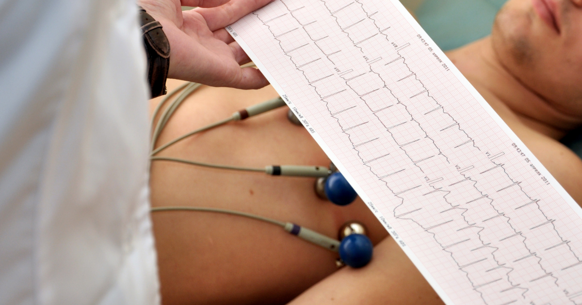 how to read an EKG
