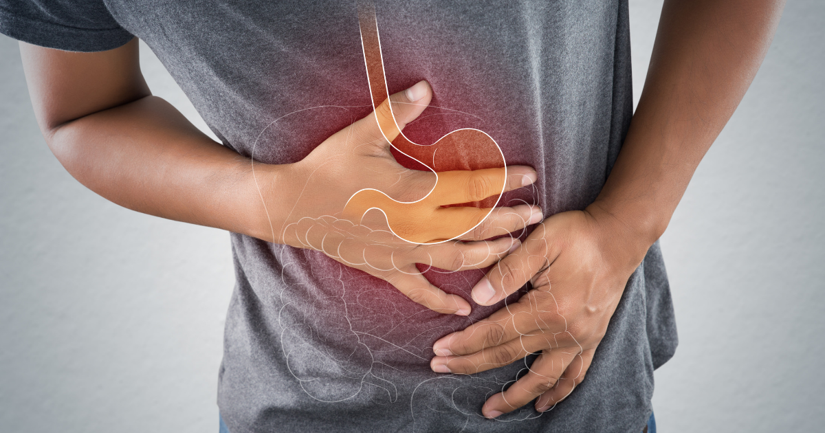 ibs signs and symptoms